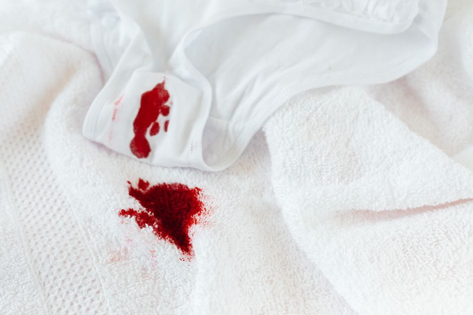 Targeted stain removal treatment on a light colored rug